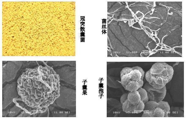 糖尿病有救吗？专家表示：这项科研未尝不可！